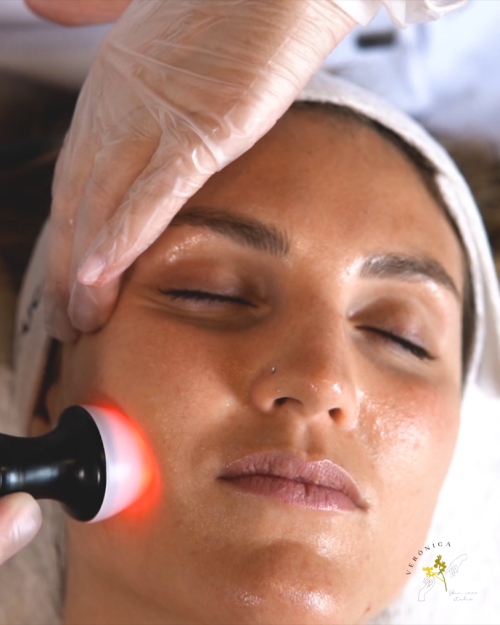 radiofrecuencia-facial